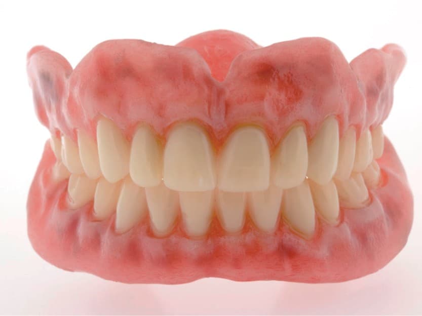 Acrylic Denture