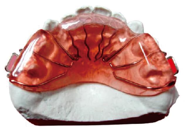 Orthodontics